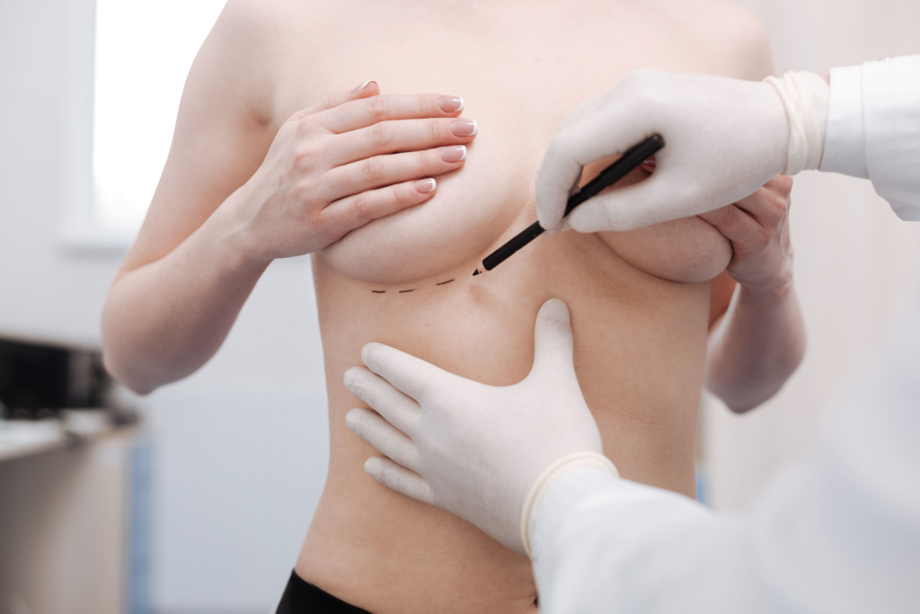 first-step-careful-precise-busy-plastic-surgeon-marking-lines-making-cuts-before-starting-procedure-inserting-implants.jpg